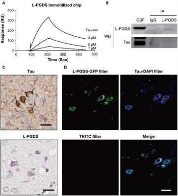 Lipocalin-type prostaglandin D synthase: a glymphopathy marker in idiopathic hydrocephalus